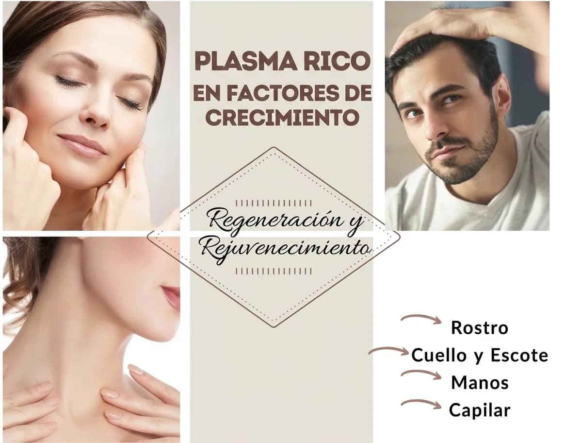 PLASMA RICO EN FACTORES DE CRECIMIENTO "PRP"