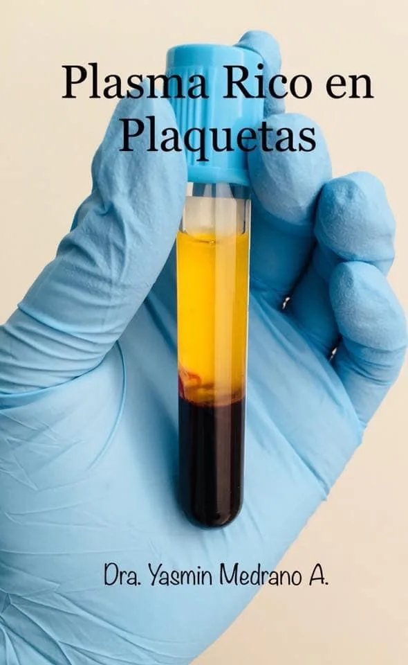 Antes — PLASMA RICO EN FACTORES DE CRECIMIENTO "PRP"